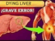 Strange Signs You May Have LIVER DAMAGE
