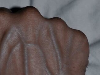 Prominent Veins on Hands: Common Causes, Meanings, and Tips to Improve Circulation