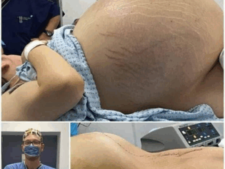She was crying with happiness, they told her she was pregnant with triplets, but the doctor when performing the cesarean section found something terrifying in her belly that amazed everyone