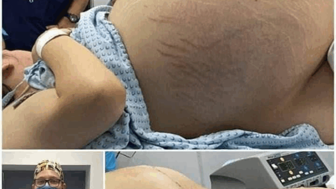 She was crying with happiness, they told her she was pregnant with triplets, but the doctor when performing the cesarean section found something terrifying in her belly that amazed everyone She was crying with happiness, they told her she was pregnant with triplets, but the doctor when performing the cesarean section found something terrifying in her belly that amazed everyone