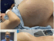 She was crying with happiness, they told her she was pregnant with triplets, but the doctor when performing the cesarean section found something terrifying in her belly that amazed everyone