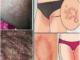 All the Symptoms of Stomach Cancer