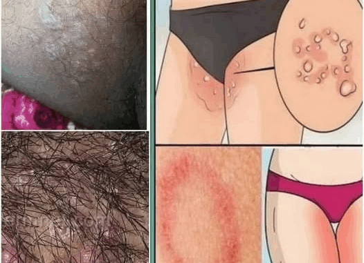 All the Symptoms of Stomach Cancer All the Symptoms of Stomach Cancer