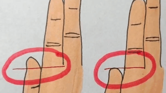 Your Fingers Could Reveal Whether You’re Rich or Poor