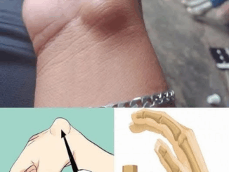 Ball in hand solution