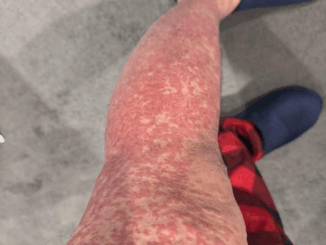 These are the consequences of sleeping with…See more