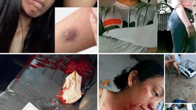 Young woman dies at the hands of her… See more Young woman dies at the hands of her… See more