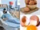 The Benefits and Risks of Eating Eggs Every Day.