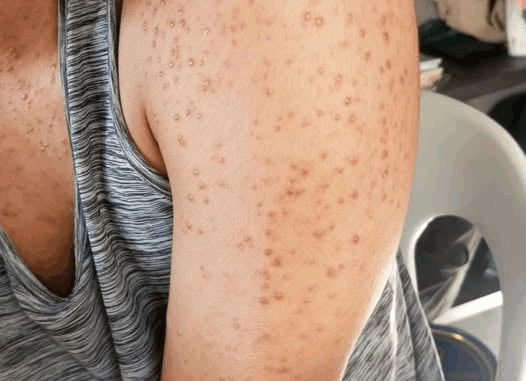 These are the consequences of sleeping with the…See more